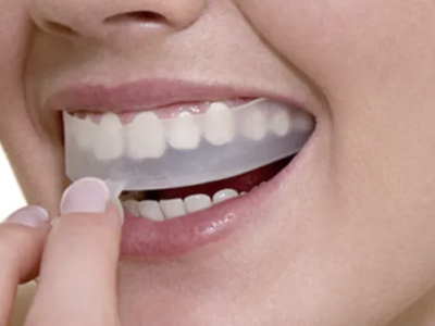 Crest Whitestrips