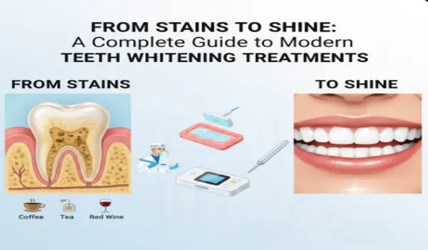 Teeth Whitening Treatment