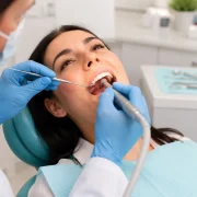 Dental Filling Treatment